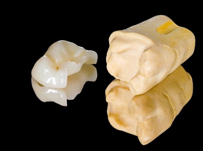 Model tooth used to explain dental bonding