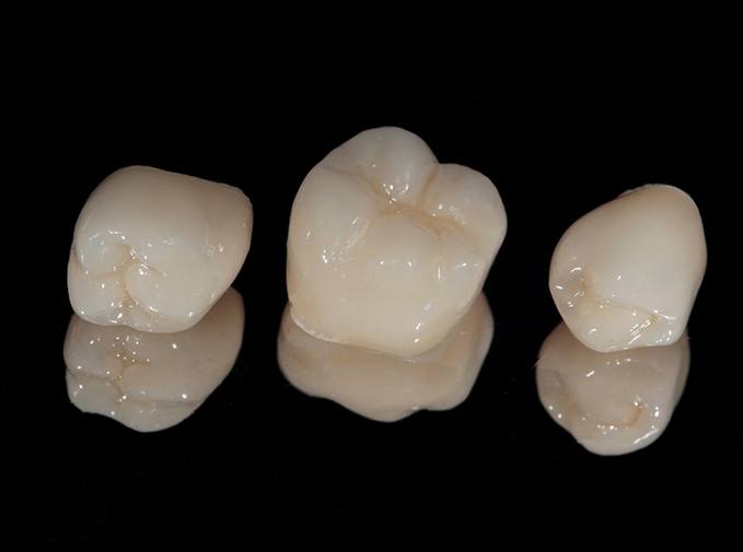 A close-up of dental crowns in Inver Grove Heights