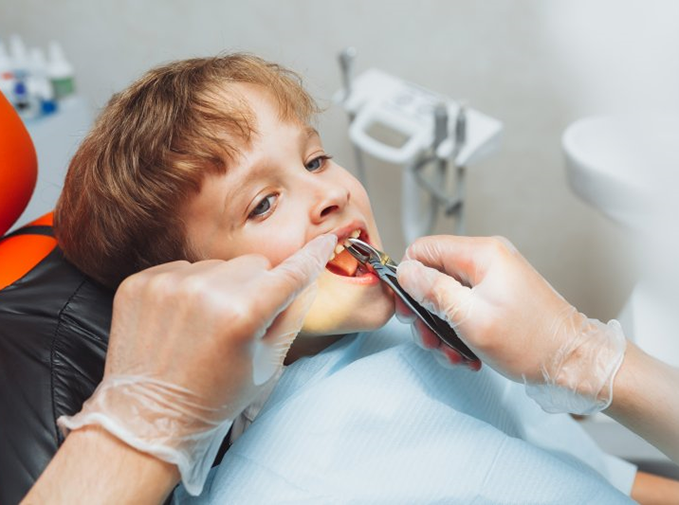 a child undergoing tooth extractions in Inver Grove Heights