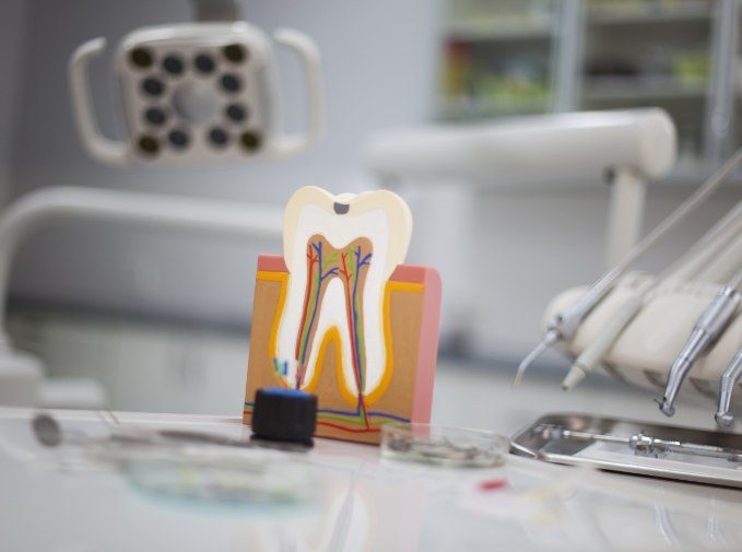 Model of the inside of a tooth used to explain pulp therapy