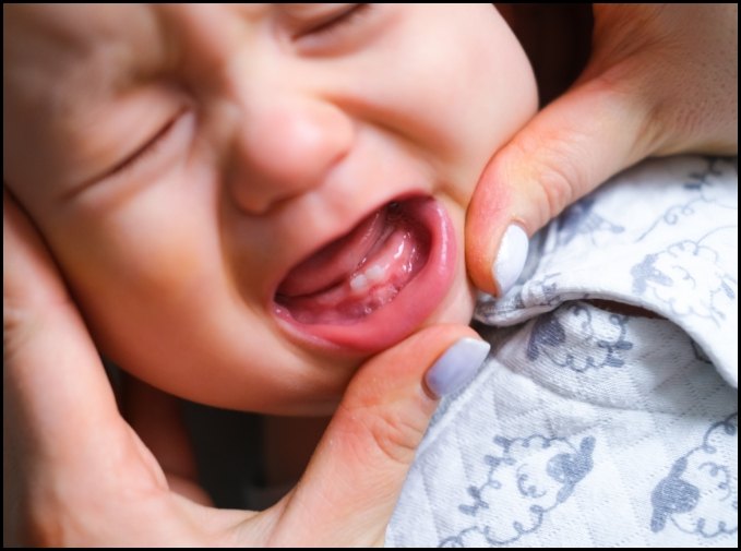 Crying baby before dentistry for infants visit